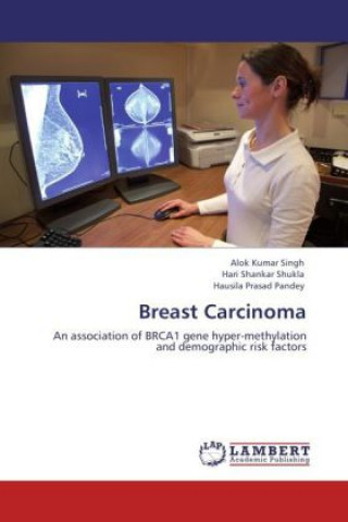 Kniha Breast Carcinoma Alok Kumar Singh