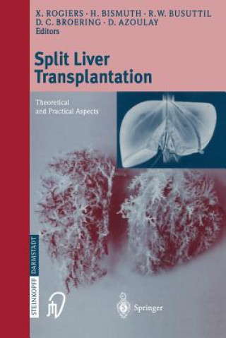 Buch Split liver transplantation D. Azoulay