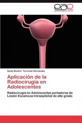 Knjiga Aplicacion de La Radiocirugia En Adolescentes Santa Beatriz Torriente Hernández