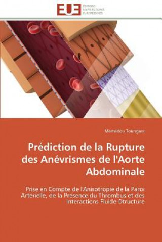 Kniha Pr diction de la Rupture Des An vrismes de l'Aorte Abdominale Mamadou Toungara