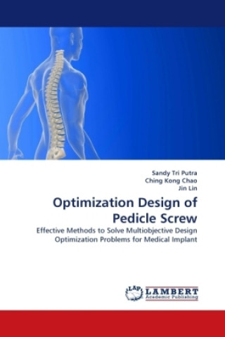 Książka Optimization Design of Pedicle Screw Sandy Tri Putra