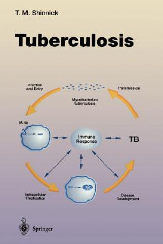 Knjiga Tuberculosis Thomas M. Shinnick