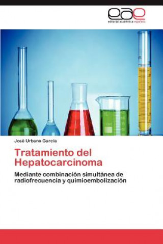 Książka Tratamiento del Hepatocarcinoma José Urbano García