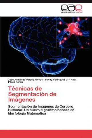 Buch Tecnicas de Segmentacion de Imagenes Jos? Armando Vald's Torres