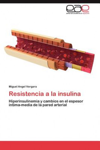 Buch Resistencia a la Insulina Miguel Angel Vergara