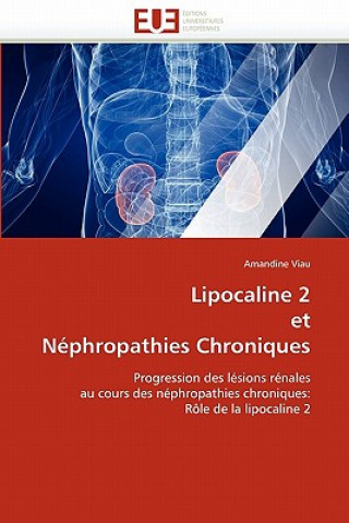 Kniha Lipocaline 2 Et N phropathies Chroniques Amandine Viau