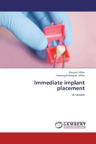 Книга Immediate implant placement Deepak Vikhe