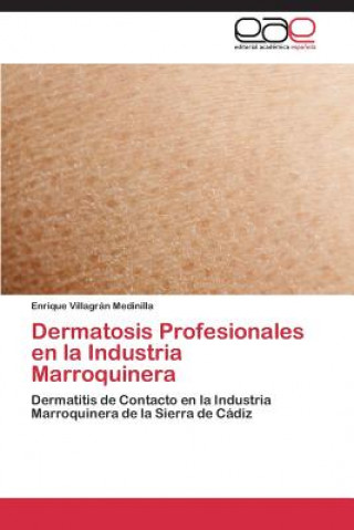 Carte Dermatosis Profesionales En La Industria Marroquinera Villagran Medinilla Enrique