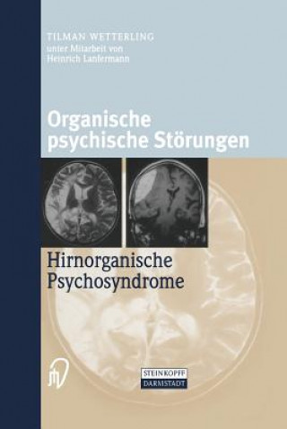 Kniha Organische psychische Störungen Tilman Wetterling