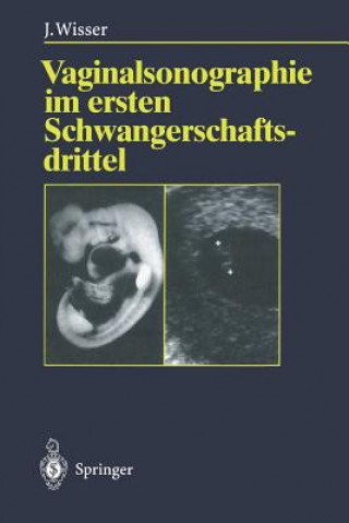 Kniha Vaginalsonographie im Ersten Schwangerschaftsdrittel Josef Wisser