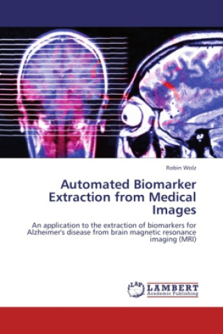 Kniha Automated Biomarker Extraction from Medical Images Robin Wolz