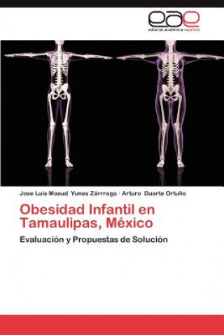 Knjiga Obesidad Infantil En Tamaulipas, Mexico Jose Luis Masud Yunes Zárrraga