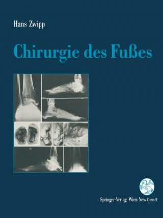 Kniha Chirurgie Des Fusses Hans Zwipp