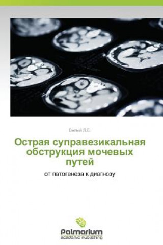 Buch Ostraya Supravezikal'naya Obstruktsiya Mochevykh Putey Belyy L.E.