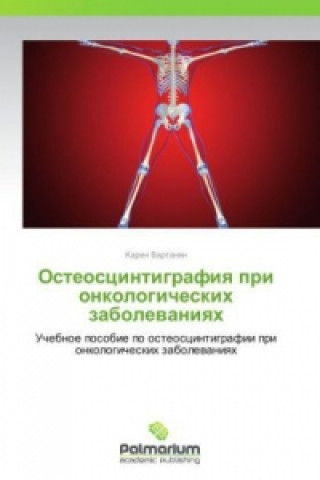 Kniha Osteostsintigrafiya Pri Onkologicheskikh Zabolevaniyakh Karen Vartanyan