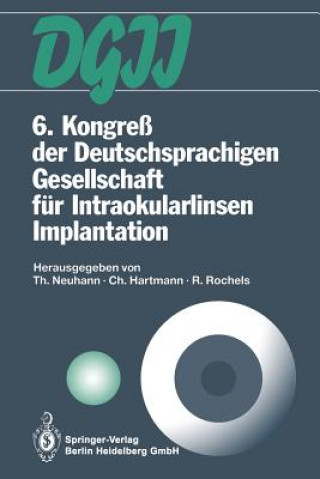 Könyv 6. Kongre  Der Deutschsprachigen Gesellschaft F r Intraokularlinsen Implantation Christian Hartmann