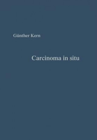 Buch Carcinoma in Situ Günter Kern