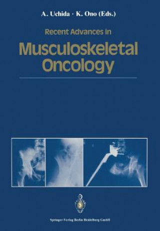 Carte Recent Advances in Musculoskeletal Oncology Keiro Ono