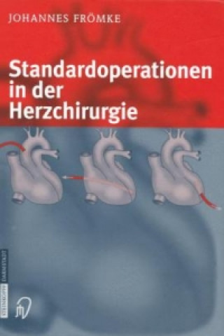 Książka Standardoperationen in der Herzchirurgie Johannes Frömke