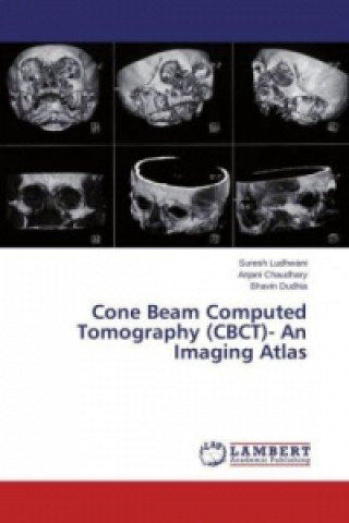 Carte Cone Beam Computed Tomography (CBCT)- An Imaging Atlas Suresh Ludhwani