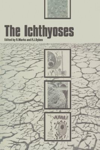 Książka Ichthyoses P. J. Dykes