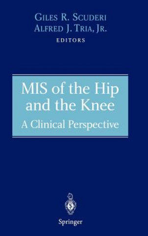 Knjiga MIS of the Hip and the Knee 