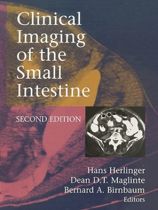 Carte Clinical Imaging of the Small Intestine 