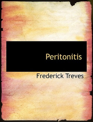 Kniha Peritonitis Treves