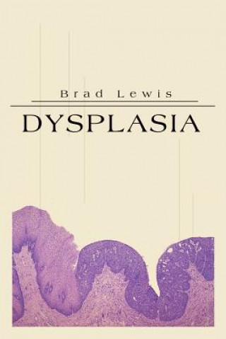 Carte Dysplasia Brad B Lewis