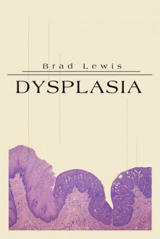 Książka Dysplasia Brad B Lewis