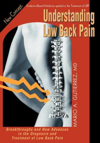 Knjiga Understanding Low Back Pain Mario A Gutierrez M D