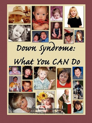 Carte Down Syndrome: What You CAN Do Qadoshyah Fish