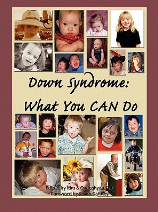 Книга Down Syndrome: What You CAN Do Qadoshyah Fish