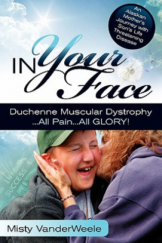 Knjiga In Your Face Duchenne Muscular Dystrophy All Pain All Glory Misty Vanderweele