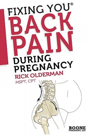 Kniha Fixing You: Back Pain During Pregnancy Rick Olderman