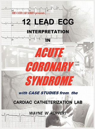 Kniha 12 Lead ECG Interpretation in Acute Coronary Syndrome with Case Studies from the Cardiac Catheterization Lab Wayne W Ruppert