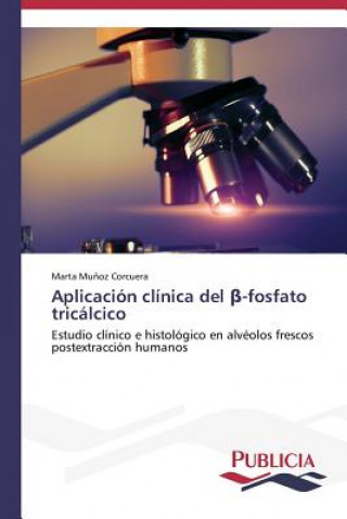 Kniha Aplicacion clinica del &#946;-fosfato tricalcico Munoz Corcuera Marta