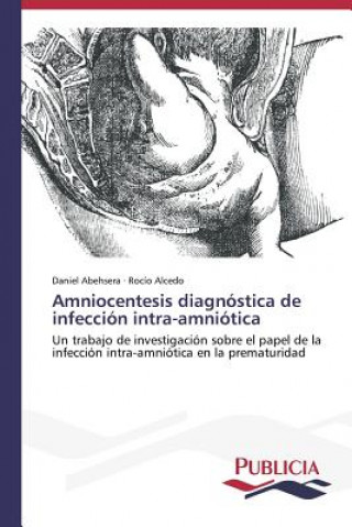 Carte Amniocentesis diagnostica de infeccion intra-amniotica Daniel Abehsera