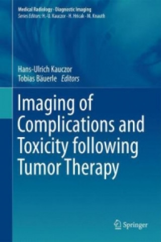 Книга Imaging of Complications and Toxicity following Tumor Therapy Hans-Ulrich Kauczor