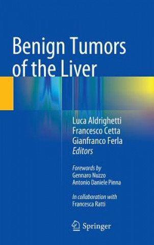 Könyv Benign Tumors of the Liver Luca Aldrighetti
