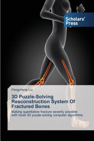 Książka 3D Puzzle-Solving Resconstruction System of Fractured Bones Liu Pengcheng