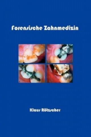 Książka Forensische Zahnmedizin Klaus Rötzscher