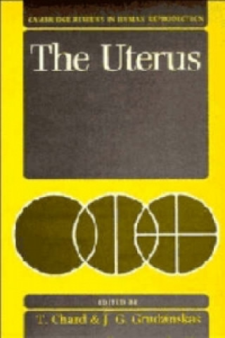 Carte Uterus 