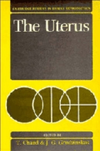 Book Uterus 