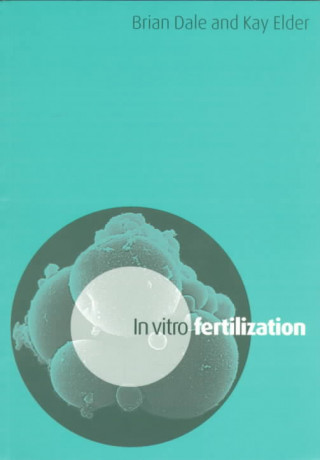 Könyv In Vitro Fertilization Kay Elder