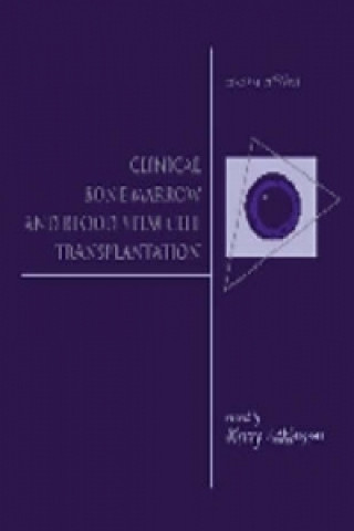 Livre Clinical Bone Marrow and Blood Stem Cell Transplantation 