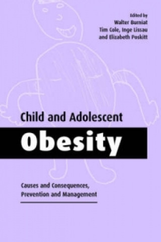 Książka Child and Adolescent Obesity 