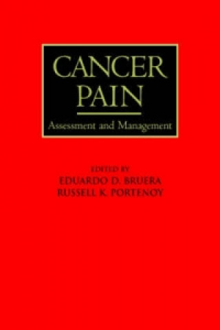Könyv Cancer Pain 