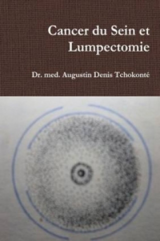 Kniha Cancer Du Sein Et Lumpectomie Dr Med Augustin Denis Tchokonte