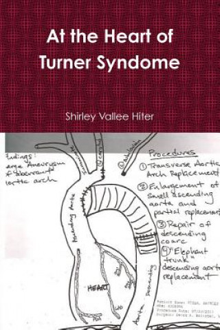 Livre At The Heart of Turner Syndrome Shirley Vallee Hiter